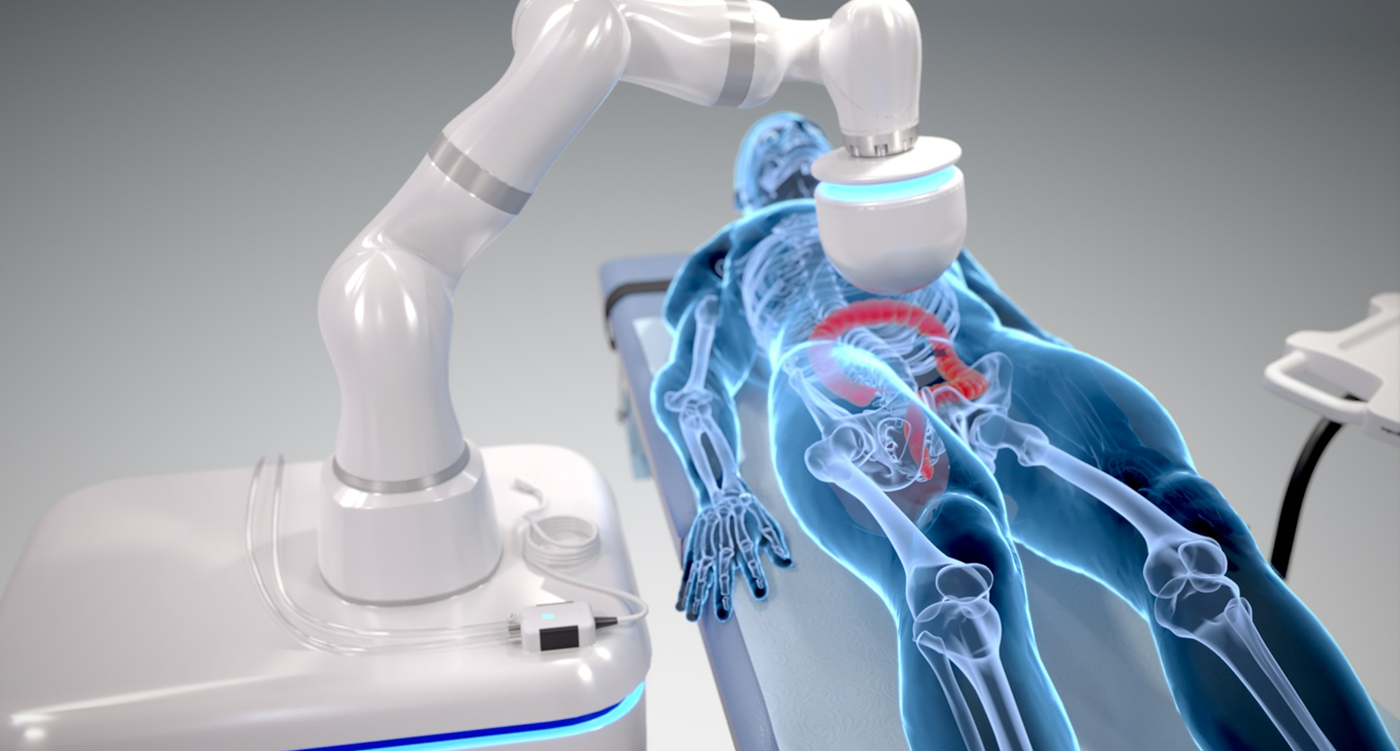 Atlas Endoscopy